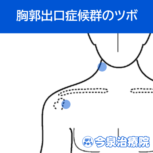 胸郭出口症候群のツボ